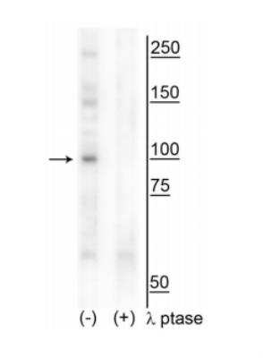 Western Blot: CtIP [p Thr847] Antibody [NBP2-60770]